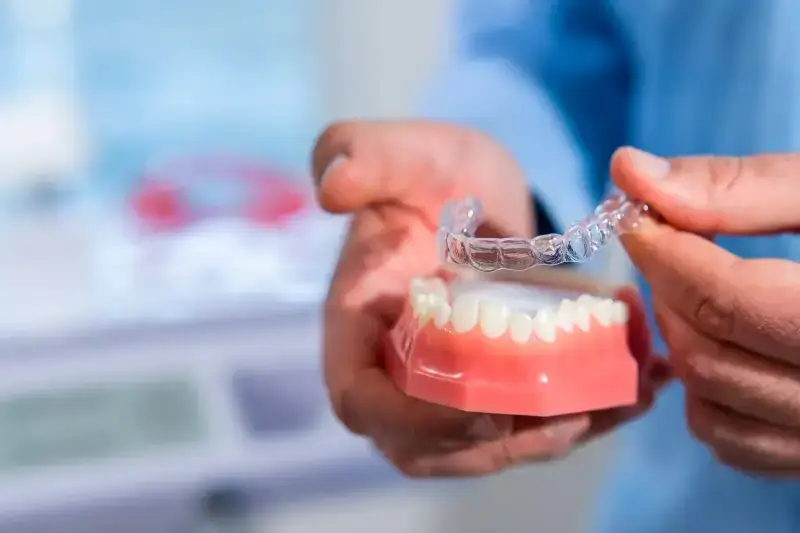 Dlaczego warto wybrać leczenie Invisalign?