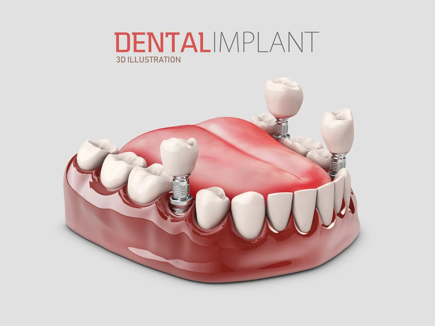 Endodoncja stomatologiczna Szczecin