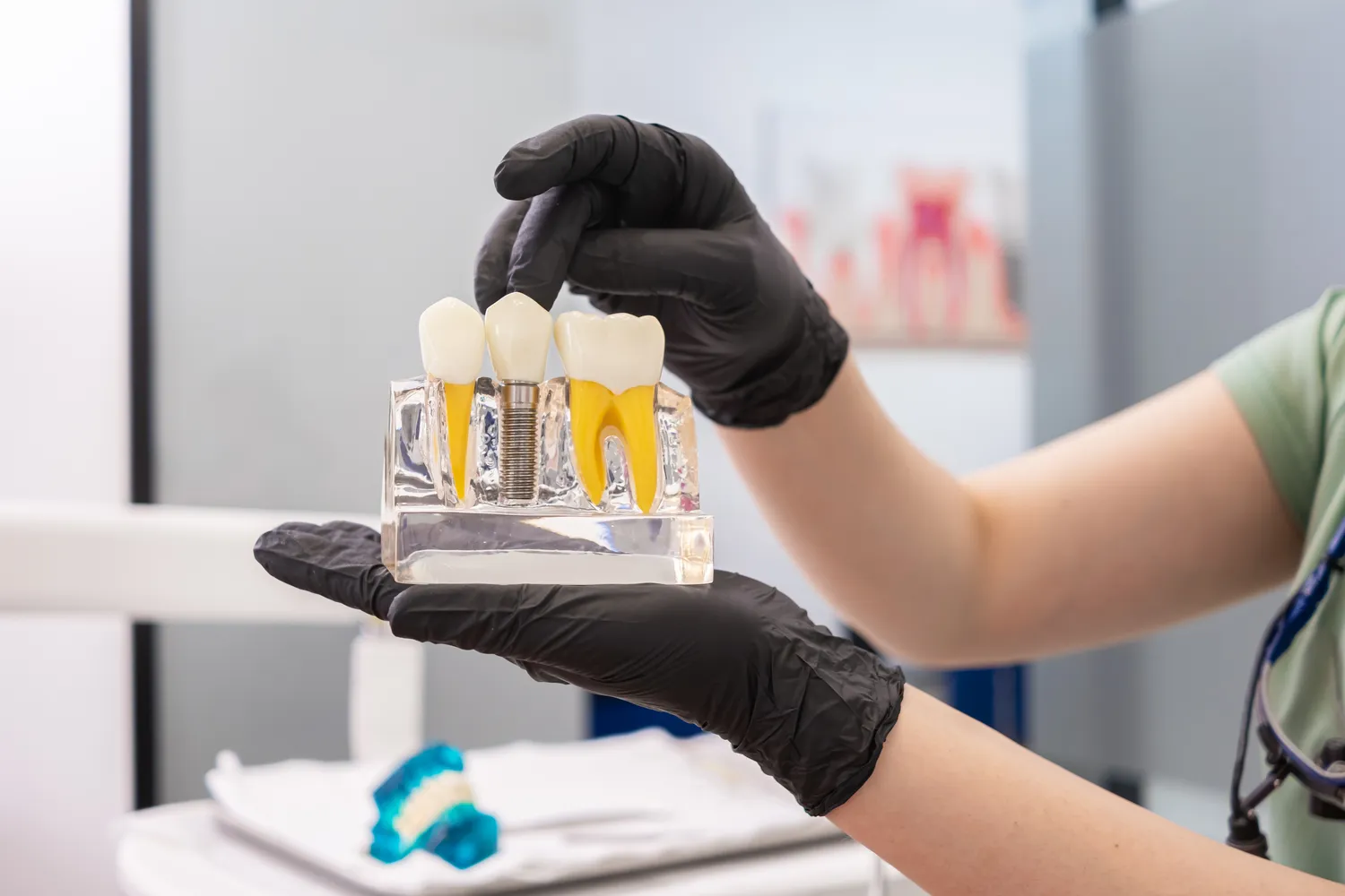 Klinika implantologiczna Warszawa