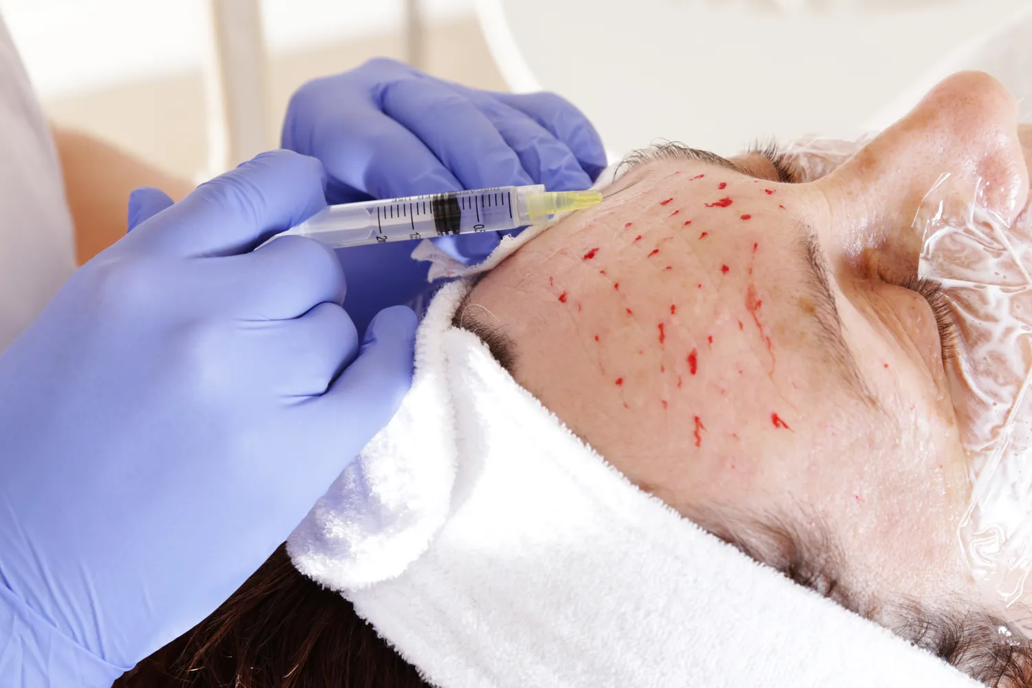 Dobry lekarz medycyny estetyczne Szczecin