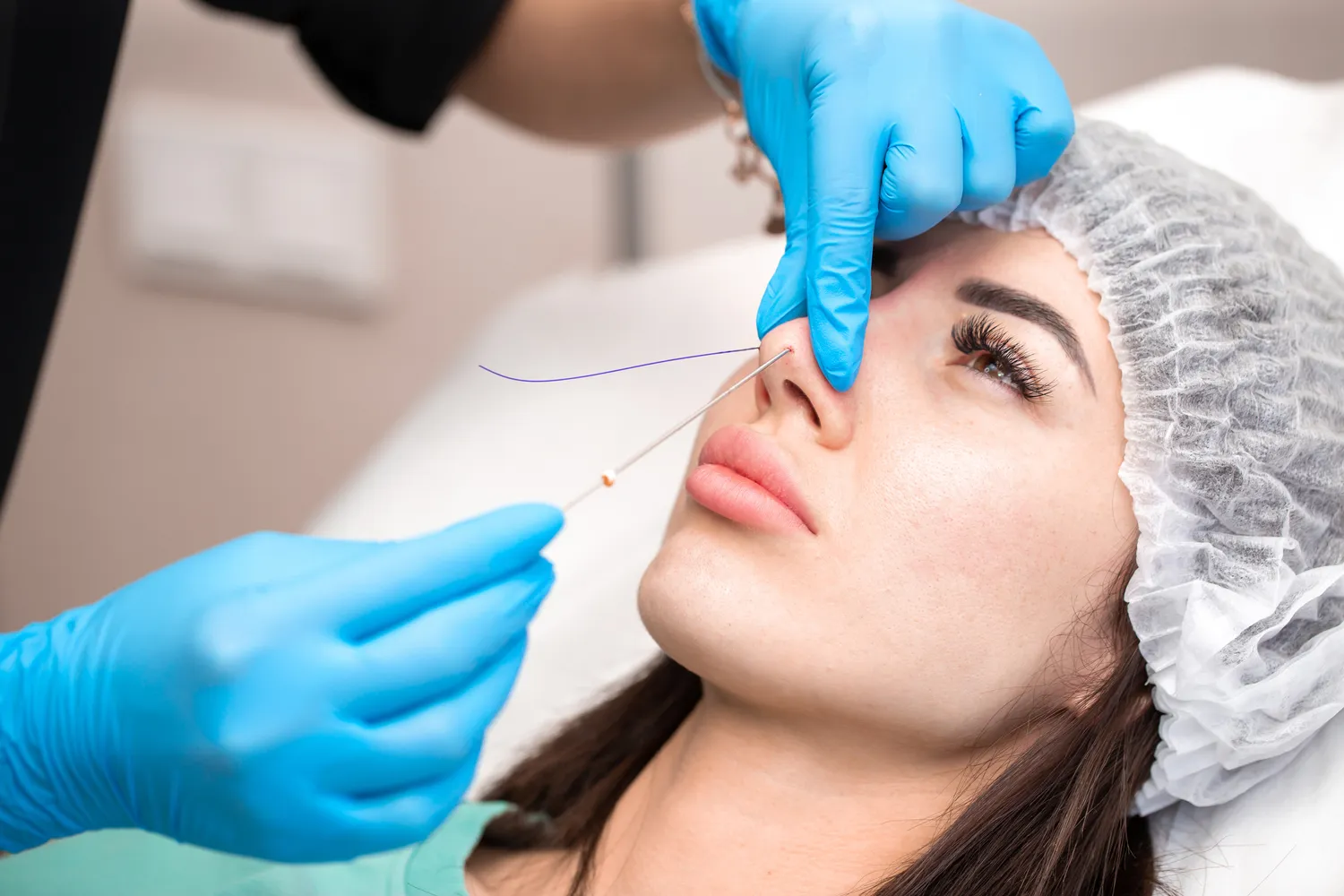 E recepta ile kosztuje?