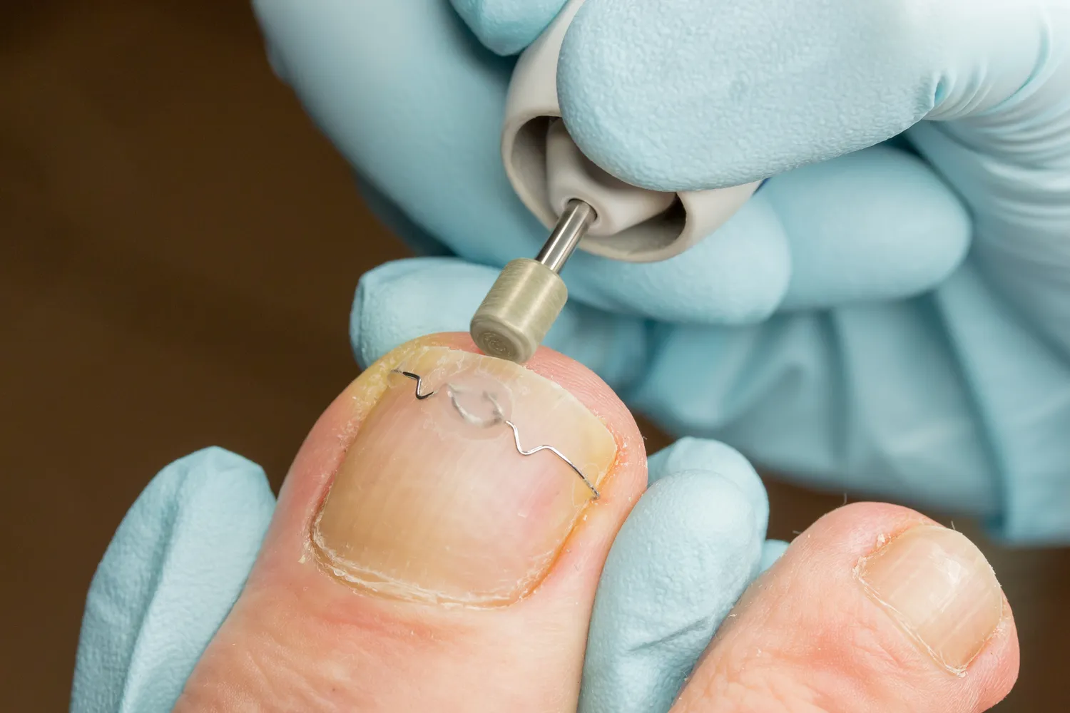  Gabinet podologiczny jako jeden z lepszych sposobów na biznes