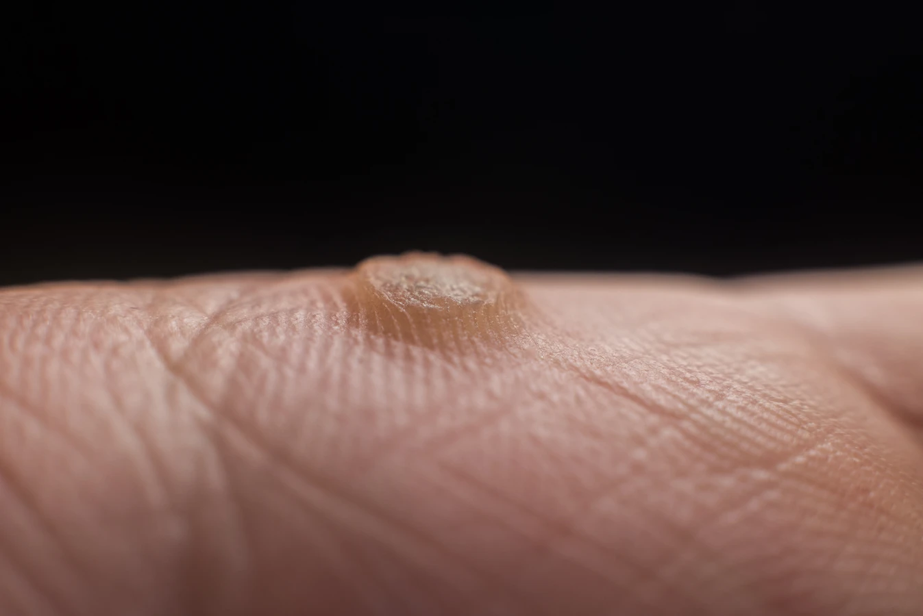 Podologia - czym jest specjalistyczna troska o stopy?